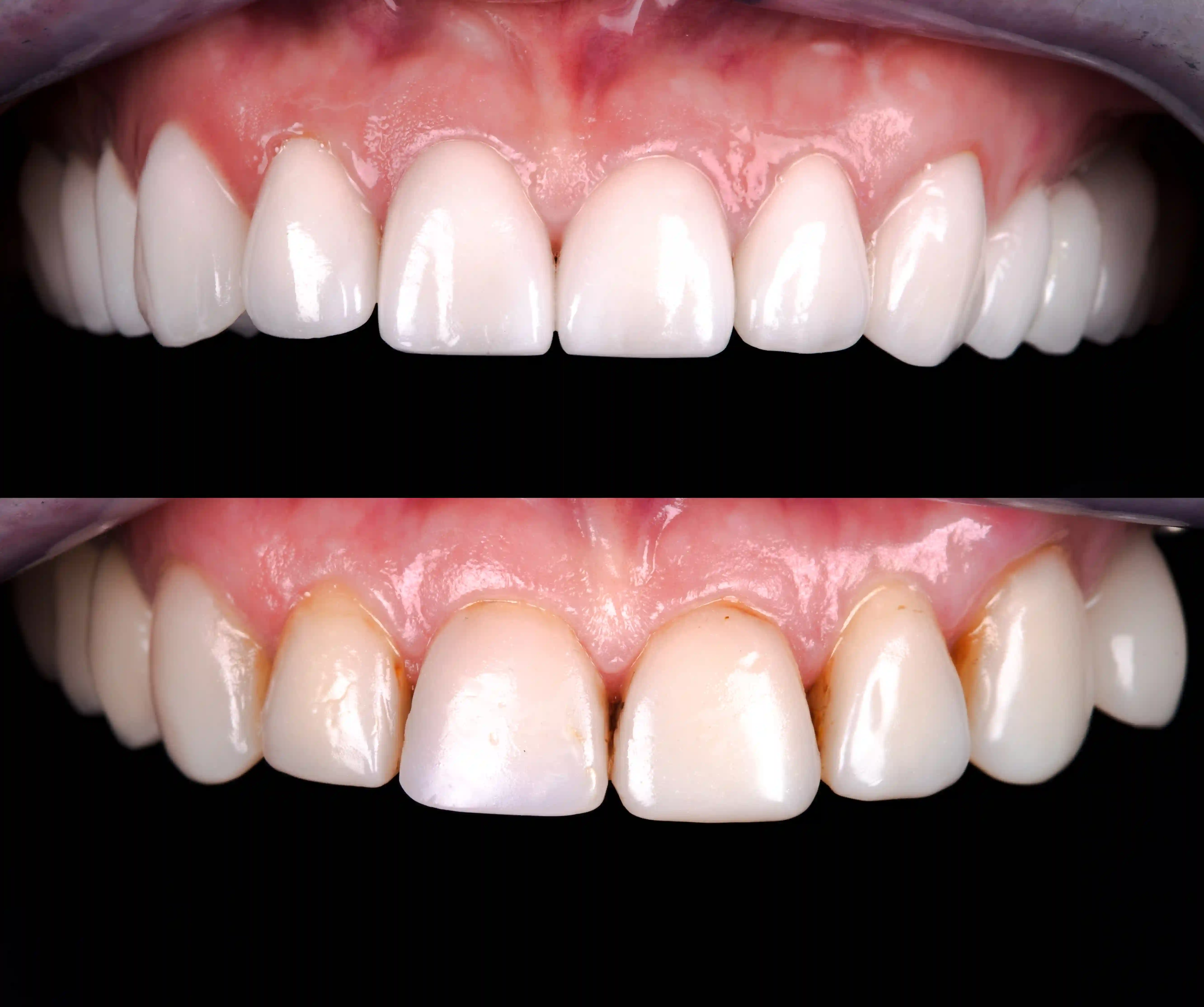 Before After Image 1