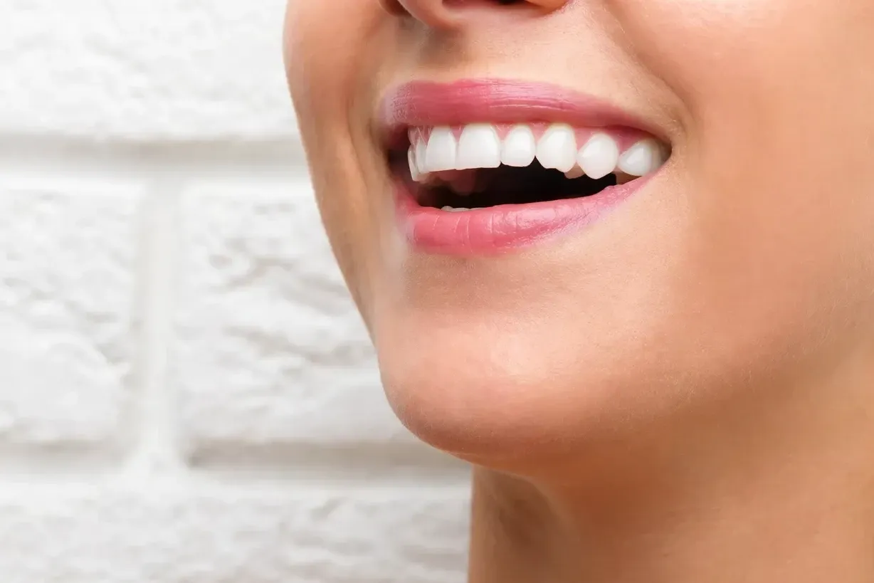 Diş Şekillendirme (Kontürleme) Nedir?