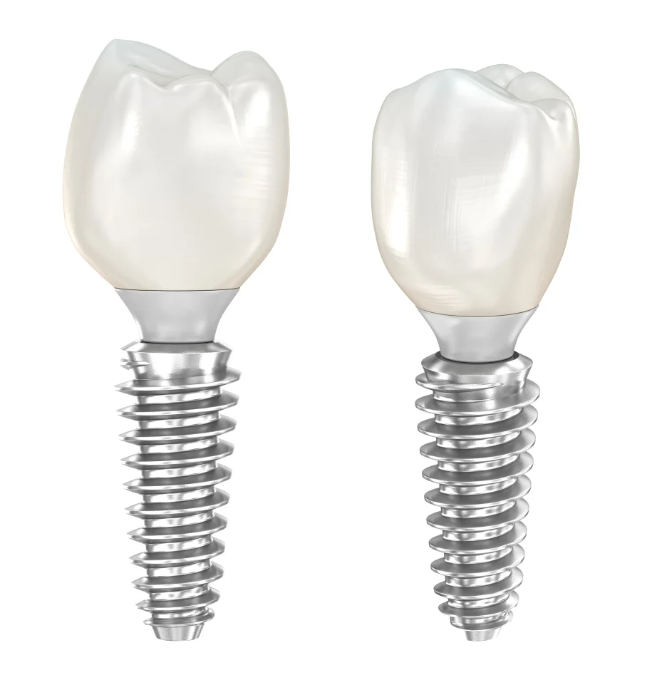 implant