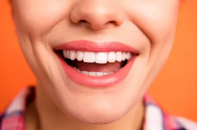 hollywood smile gülüş tasarımı