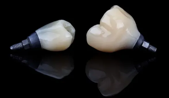 implant üstü zirkonyum kron