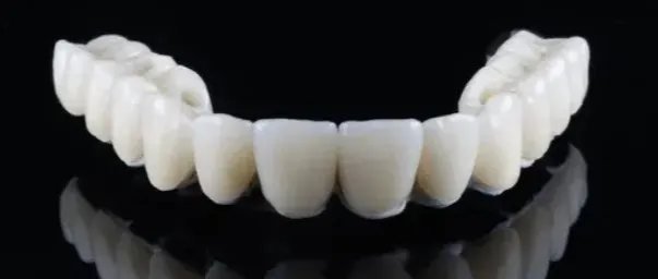 hollywood smile gülüş tasarımı